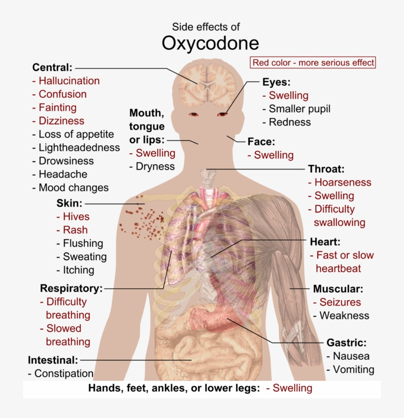 Side Effects Of Oxycodone - Cat Drug Side Effects, transparent png download