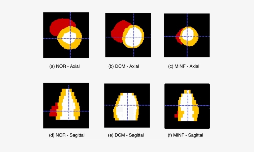 The Figures Shows The Short Axis Cardiac Segmentation - Circle, transparent png download