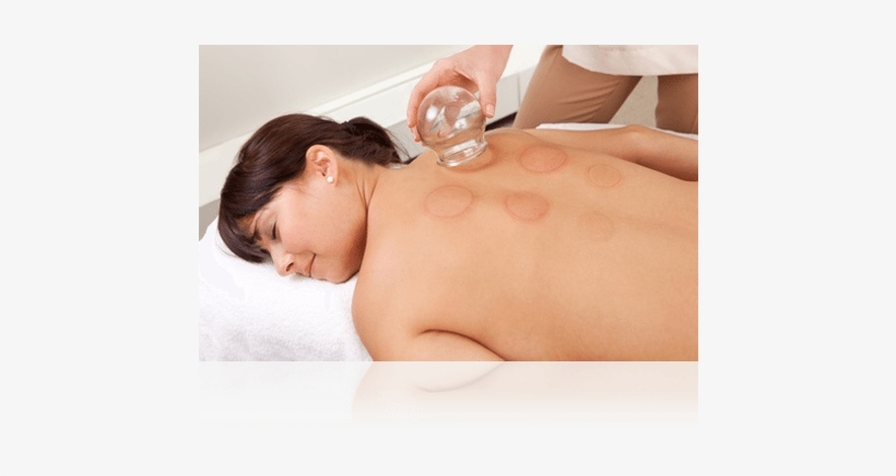 Lady Having Acupuncture - Acupuncture, transparent png download