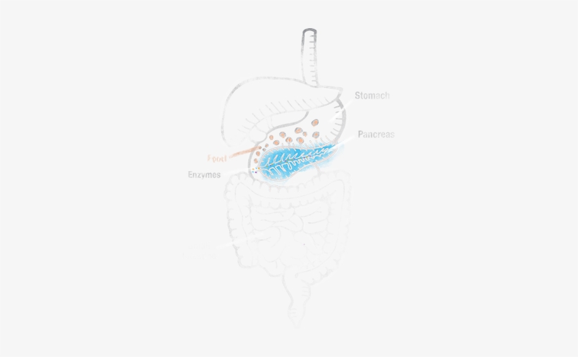 Exocrine Pancreatic Insufficiency Is A Condition That - Exocrine Pancreatic Insufficiency, transparent png download