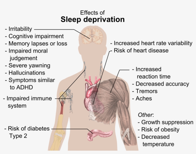 I'll Sleep When I'm Dead - Effects Of Sleep Deprivation, transparent png download