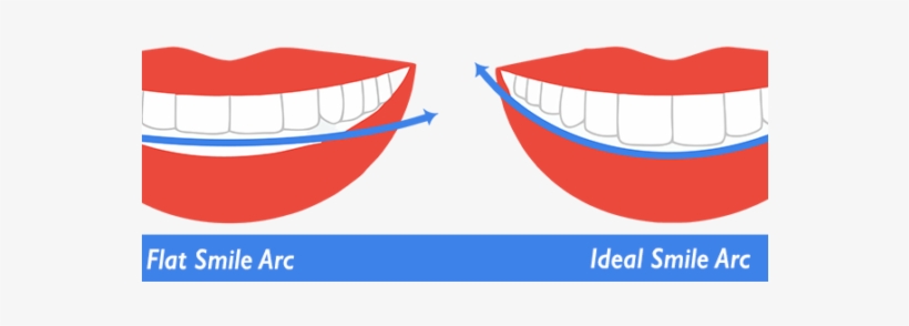 La Habra/chino Hills, Ca Gire Orthodontics Is An Orthodontic - Flat Vs Curve Smile Arc, transparent png download