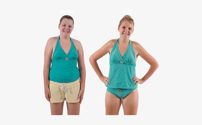 Weight Loss Camps - Camp Shane Before And After, transparent png download