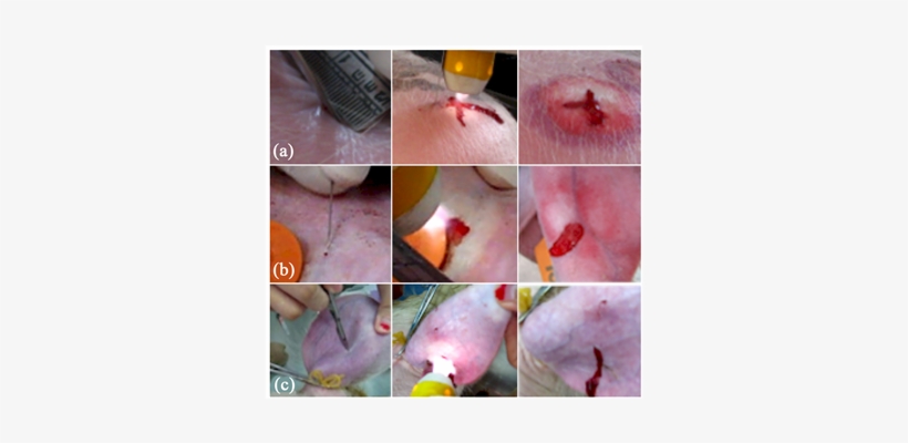 Photos Showing ) Cutting By A Scalpel, Treating This - Art, transparent png download