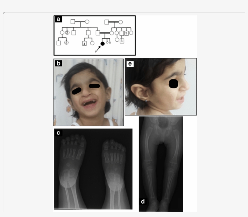 Panel Shows The Pedigree Chart Of The Patient - Patient, transparent png download