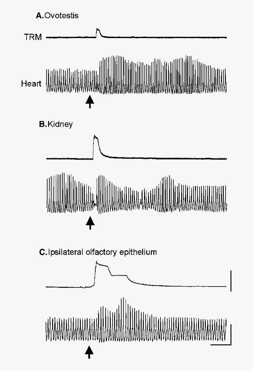 Arrows Indicate Timing Of A Light Brush Stroke Over - Diagram, transparent png download