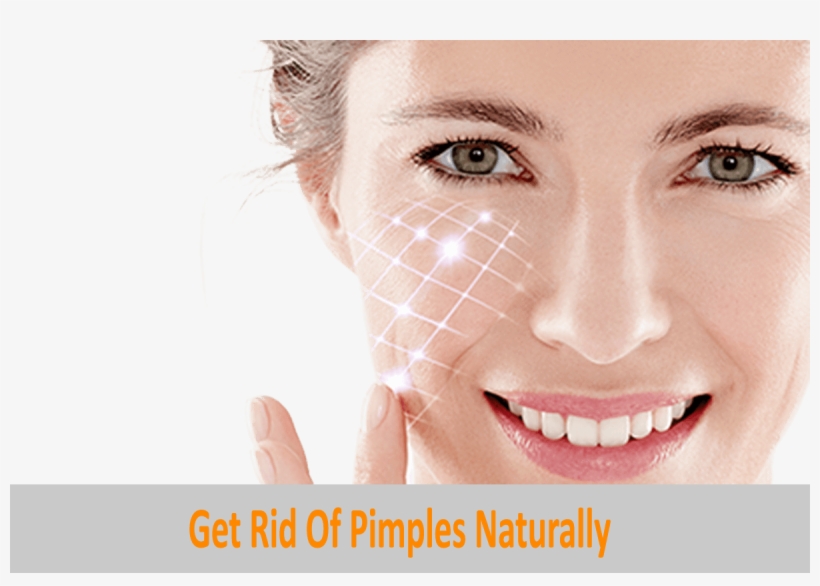 Get Rid Of Pimples Naturally Topskinlighteningcreams - Health, transparent png download
