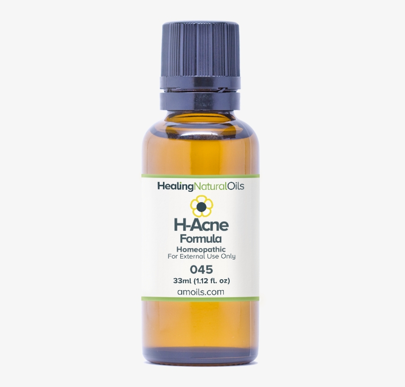 Formula H-acne Formula - Cold Sore Symptoms Before, transparent png download