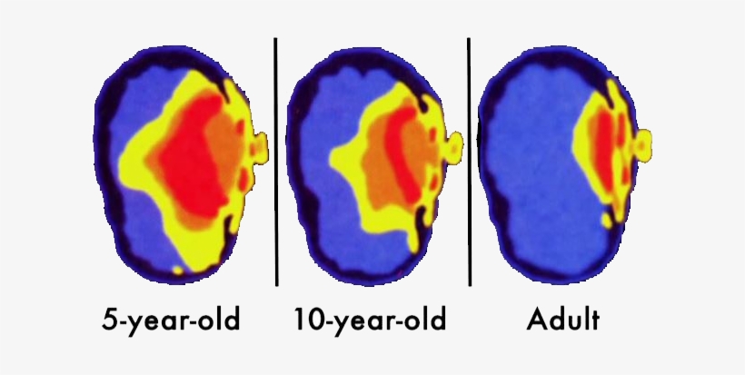 Research Shows That The Effects Of This Can Be Even - Phone Radiation, transparent png download