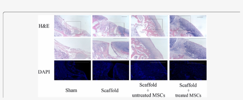 Pathological Analyses Of Radial Shockwave Treated Mscs - Tile, transparent png download