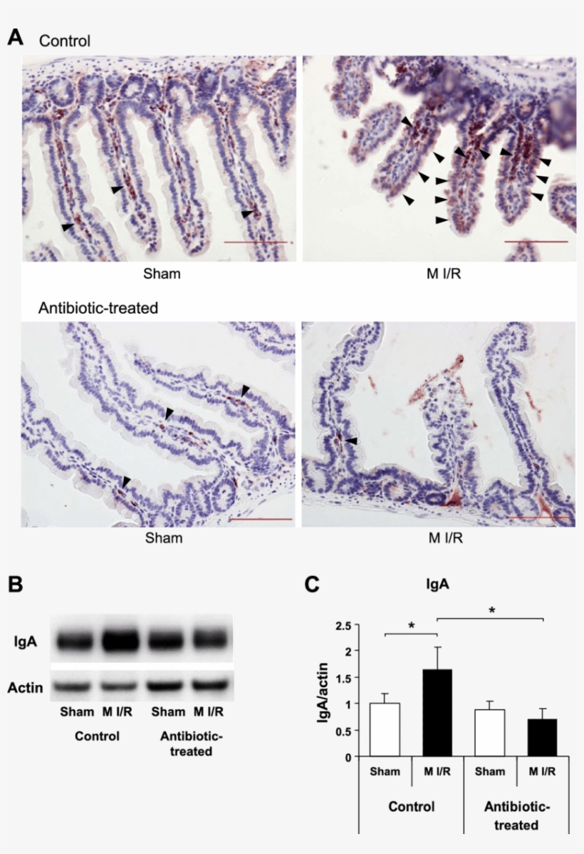 Iga Deposition In Small Intestine Following M I R We - Number, transparent png download