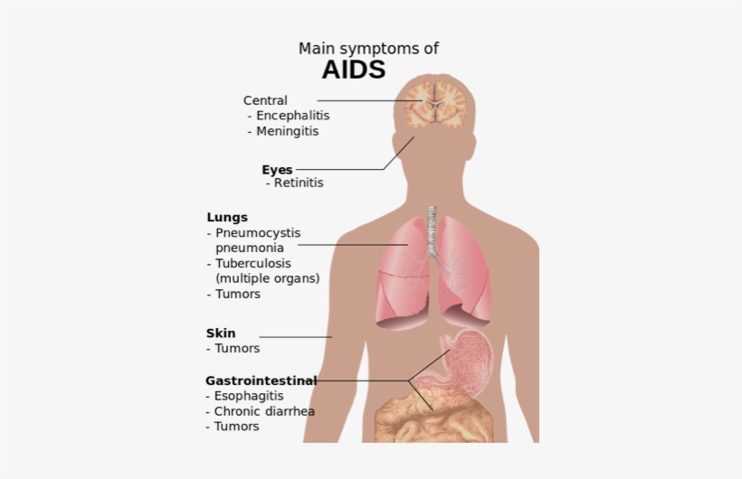 With The Potential To Decrease Inhibition, Ecstasy - Long Can You Live With Aids, transparent png download
