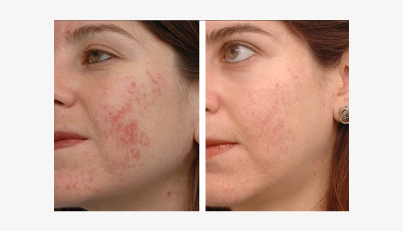 Members' Booking Form - Garmi Danay On Face, transparent png download