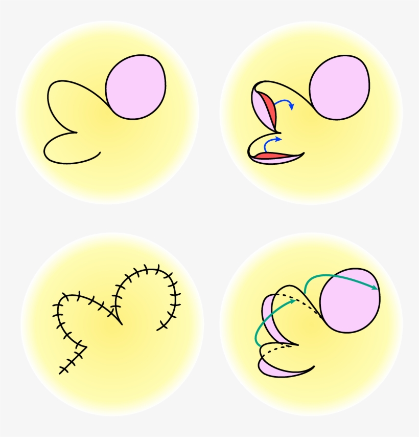 Top Left - Circle, transparent png download
