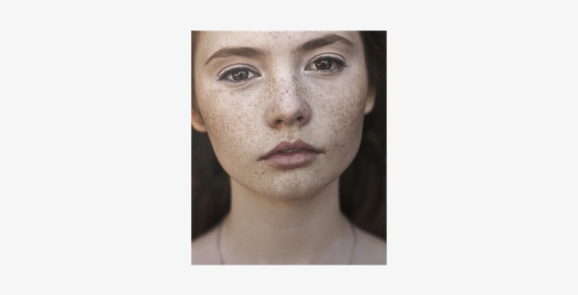 Portrait Of A Beautiful Brunette With Freckles Poster - Black Spots In Face, transparent png download