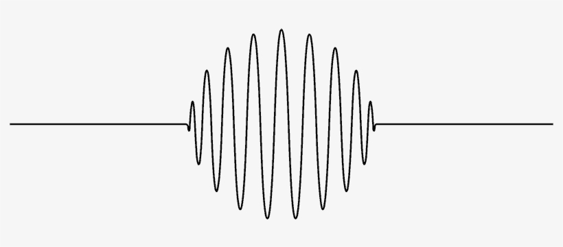 Causes Of Conductive Hearing Loss - Diagram, transparent png download