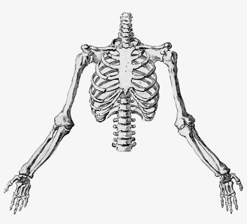 Radiographs Were Easy Enough To Come By Hospitals Produced - Illustration, transparent png download
