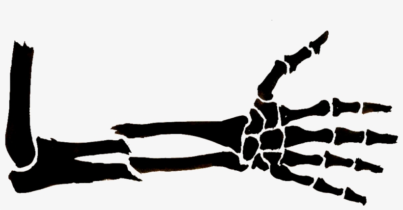 Broken Arm - Broken Arm Drawing, transparent png download