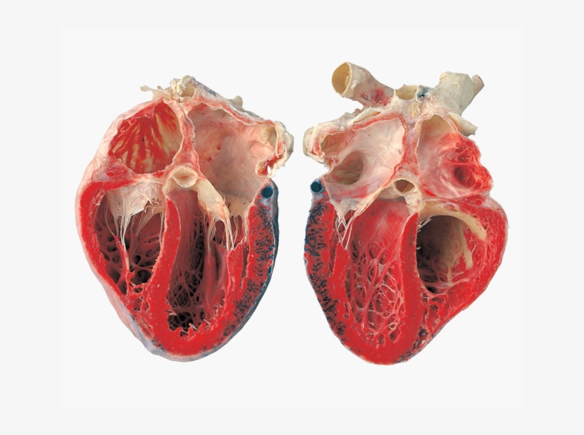 Open-heart - Food That Looks Like The Heart, transparent png download
