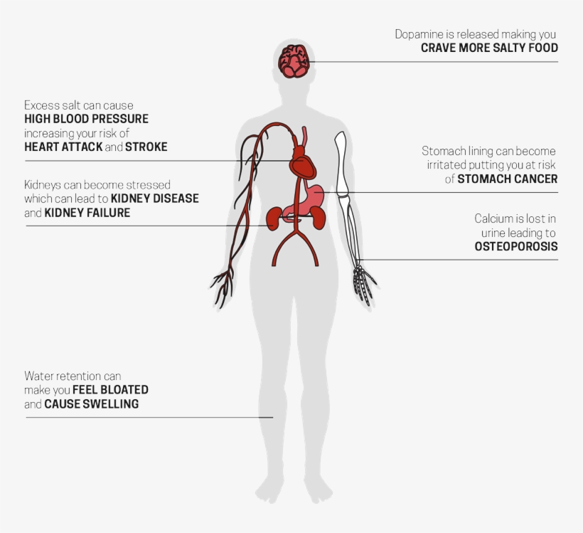 Being Physically Active, Maintaining A Healthy Weight - High Blood Pressure Body Diagram, transparent png download