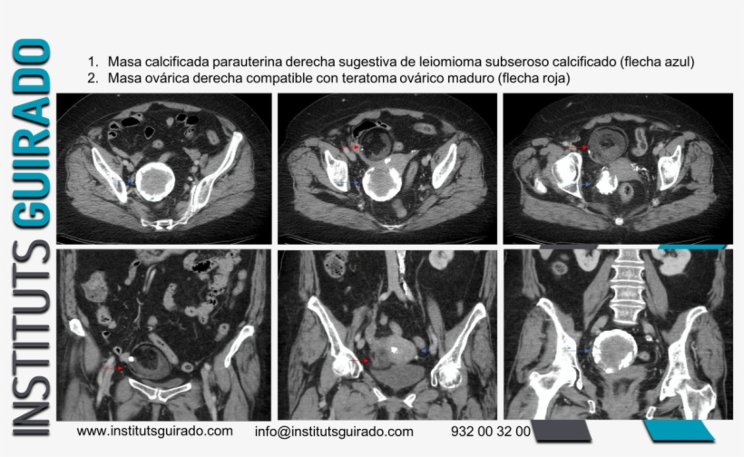 Instituts Guirado - Computed Tomography, transparent png download