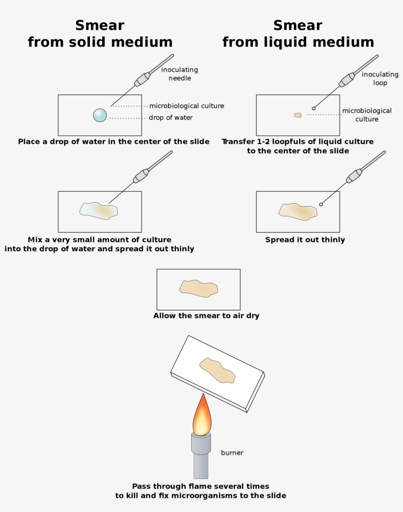 Open - Preparat W Kropli Wiszącej, transparent png download
