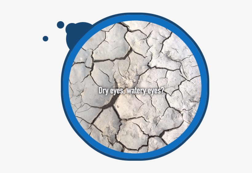 Are Your Eyes Tired Or Sore - Cobblestone, transparent png download