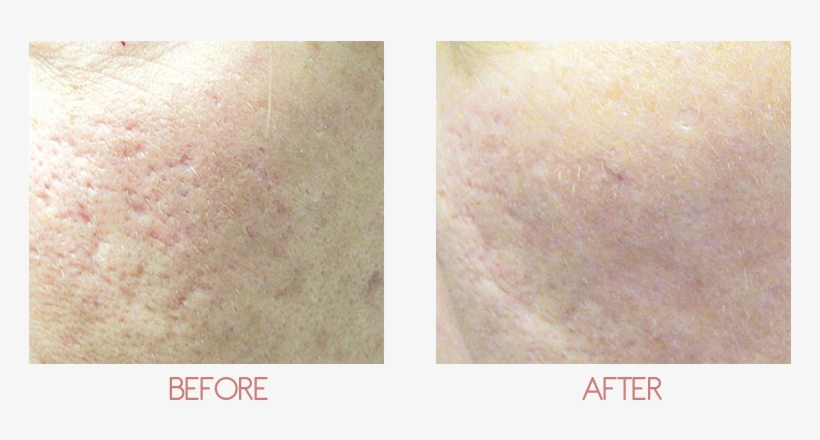 About - Scar, transparent png download