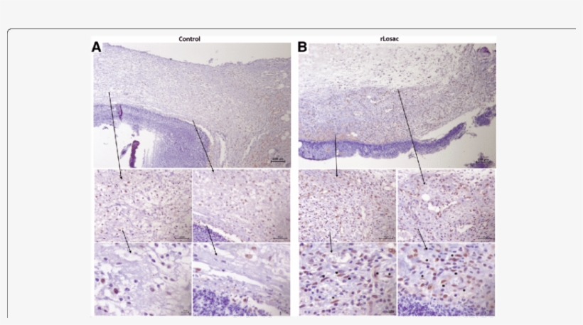 Assessment Of Scar Tissue By Pcna Immunohistochemistry - Common Fig, transparent png download