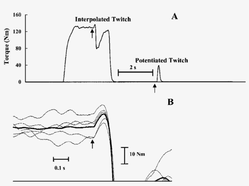 A Typical Example Of Measurement Using The Twitch Interpolation - Measurement, transparent png download