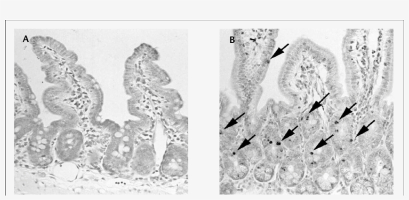 Apoptotic Changes In The Intestines Of Mice Induced - Photograph, transparent png download