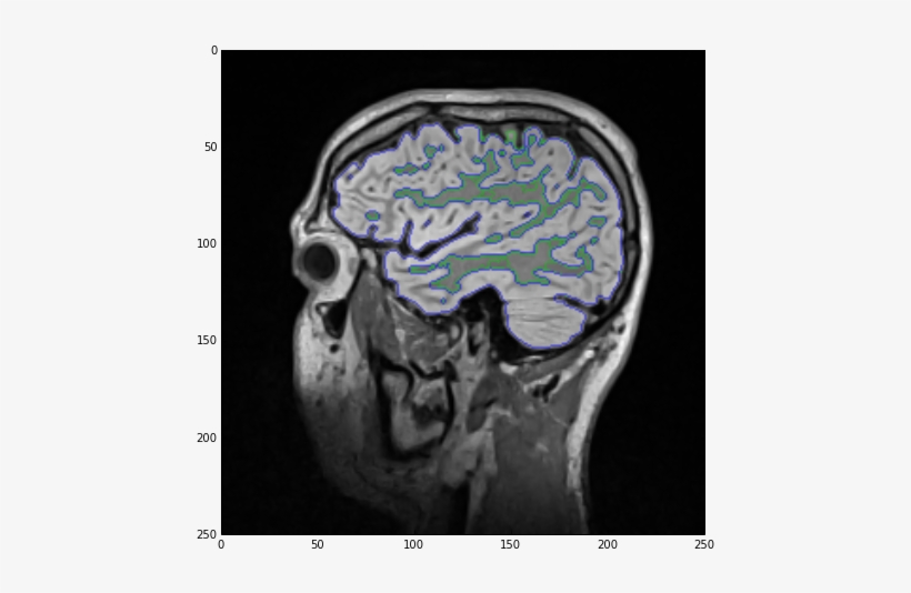 Label Overlay Showing Both White And Gray Matter As - Grey Matter, transparent png download