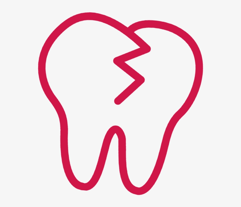 Wisdom Teeth Removal - Human Tooth, transparent png download