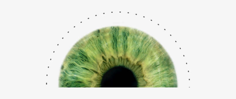 With Conventional Macular Laser - Close-up, transparent png download