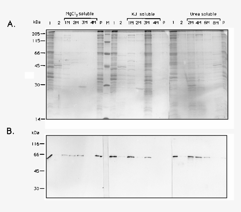 Silver-stained Sds 12% Polyacrylamide Gel Of Triton - Diagram, transparent png download