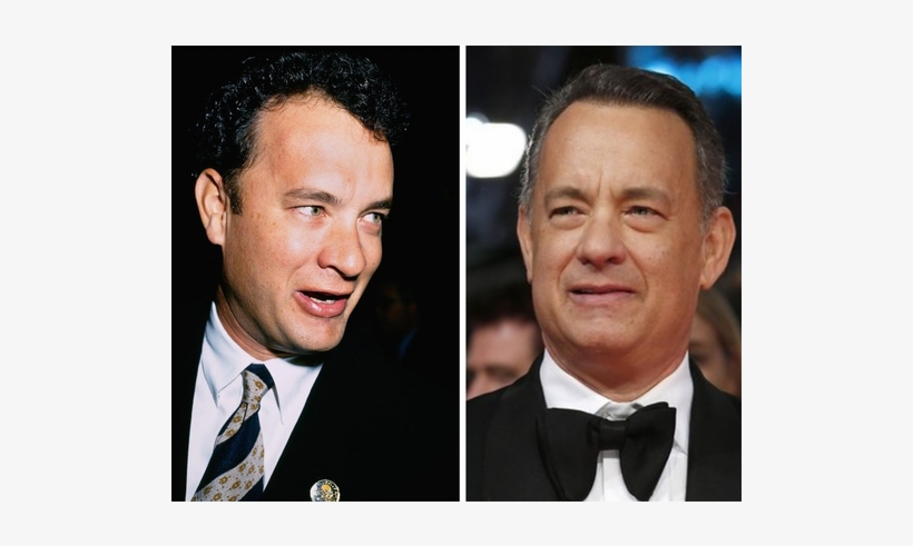 Tom Hanks, 1995 Vs - Tom Hanks Before Hair Transplant, transparent png download