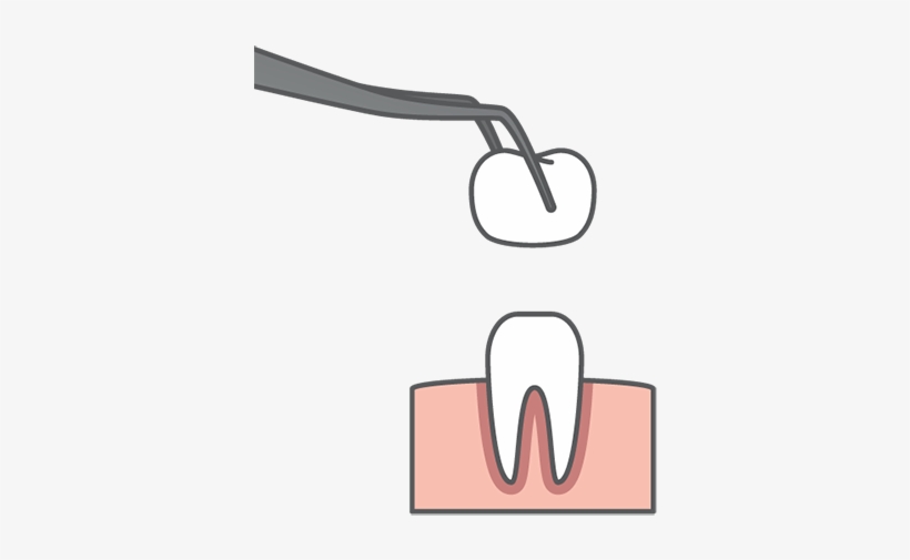 Crown - Auburn Hills Family Dentistry, transparent png download