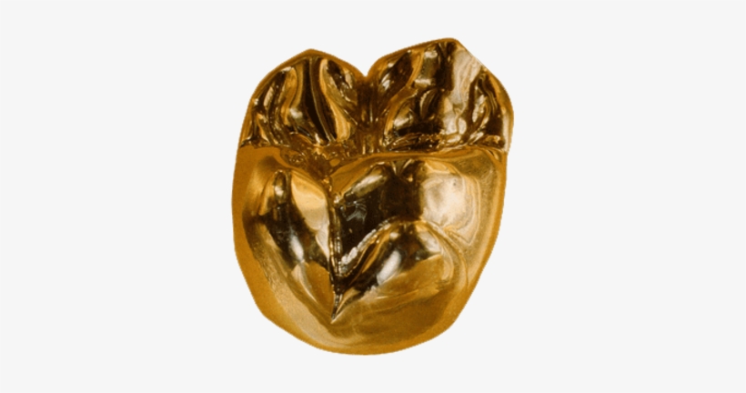 Gold Crown - Gold Crowns And Bridges, transparent png download