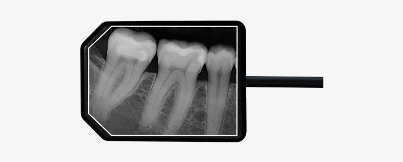Apex Dental Sensor X Rayapex Dental Sensor X Ray - Dental X Ray Sensors, transparent png download