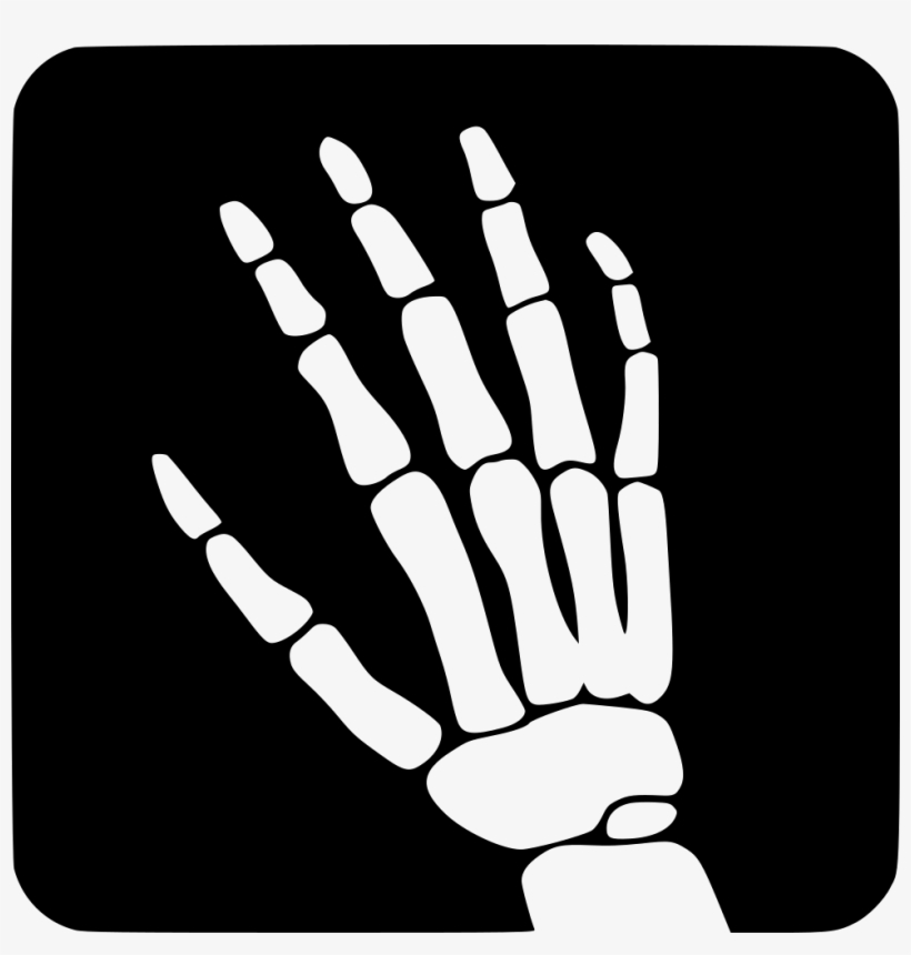 Png File Svg - Xray Icon, transparent png download