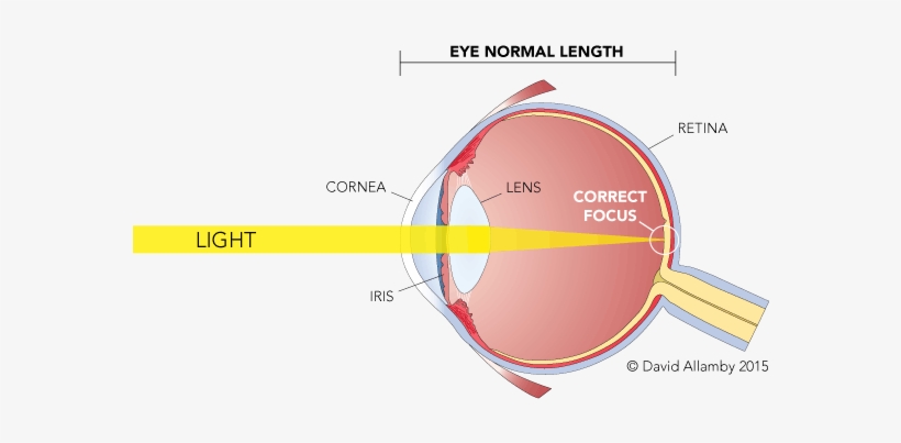 Myopia, The Medical Term For Near-sightedness, Is Most - Light Passes Through The Cornea, transparent png download