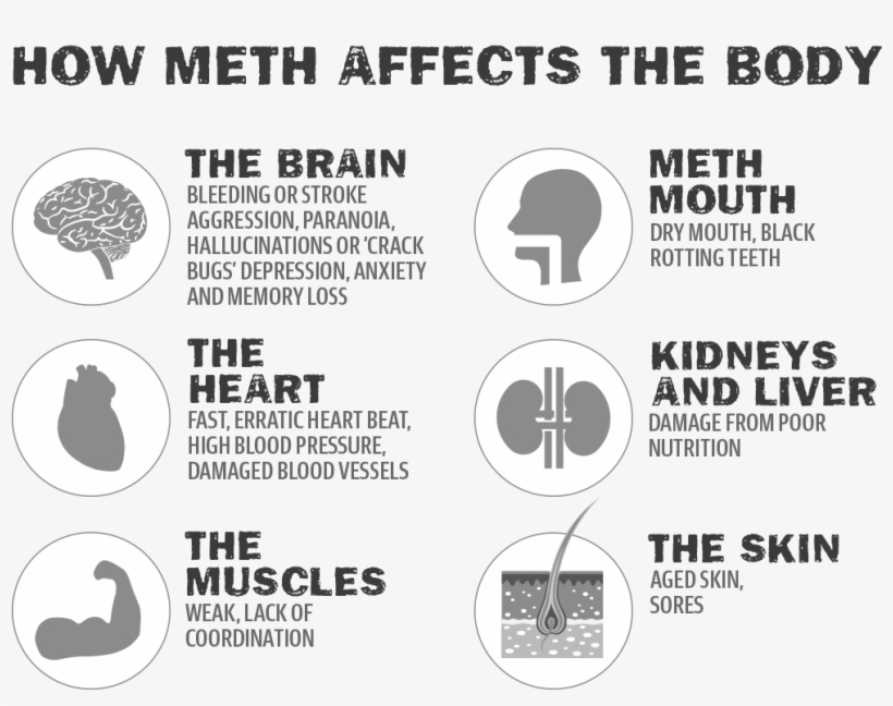 Methonbody - Ice Effects On The Brain, transparent png download