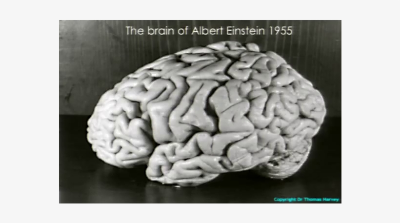 Throughout History, Body Parts Of Geniuses Shards Of - Albert Einstein Death Place, transparent png download