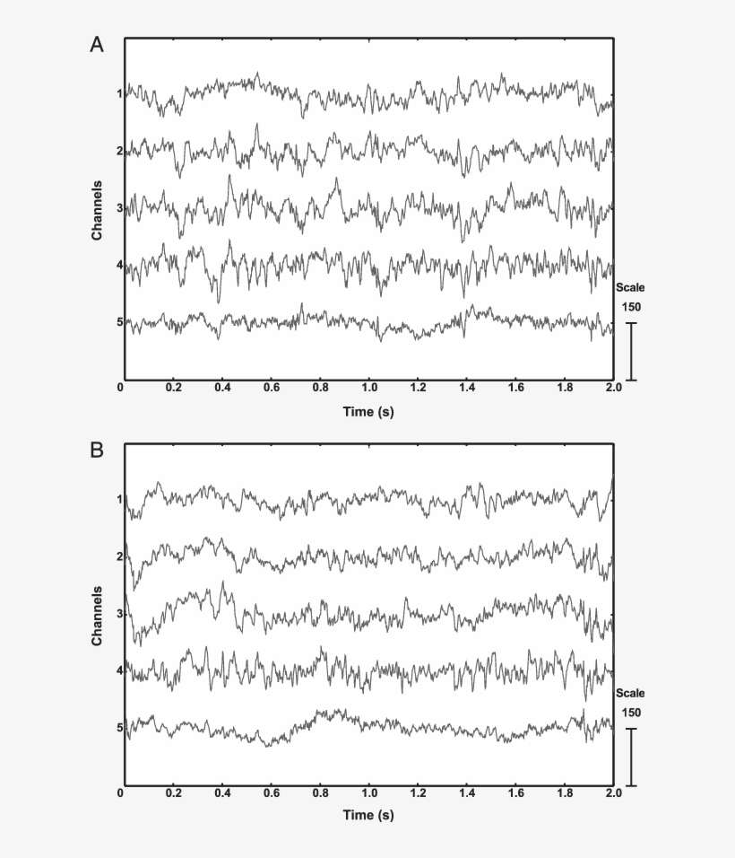 Eeg Record From The Flying And Resting Pigeon (b) That - Flight, transparent png download