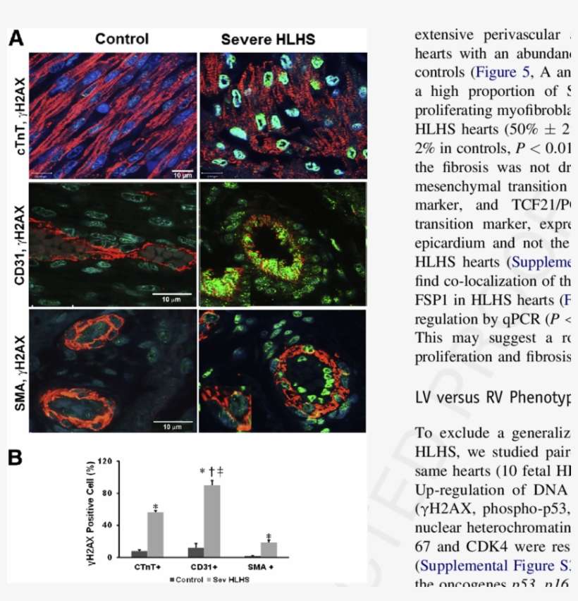 Double Staining Of The Lv For Gh2ax (green, Nuclear) - Parallel, transparent png download