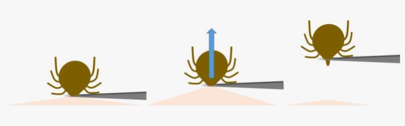 Removing A Tick With Tweezers - Tick, transparent png download