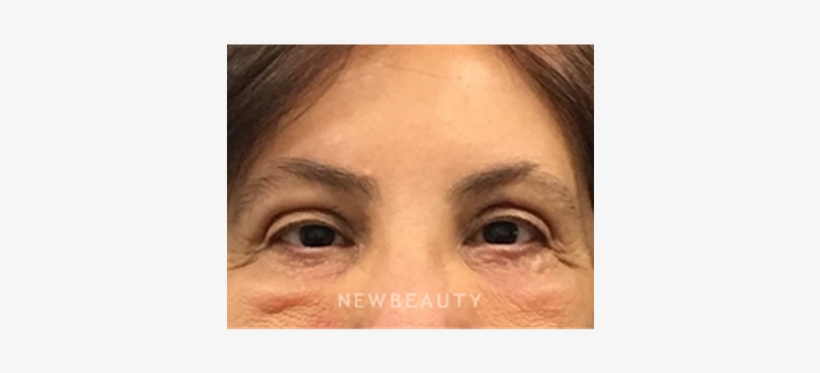 Dr Dav - Close-up, transparent png download