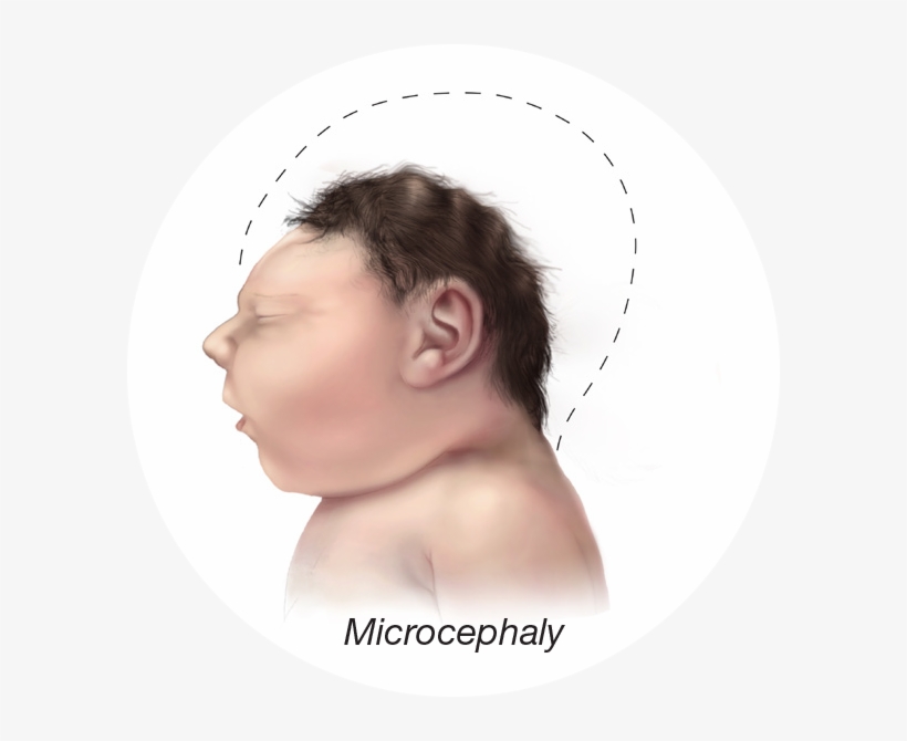 Baby Small Head - Pregnant Head, transparent png download