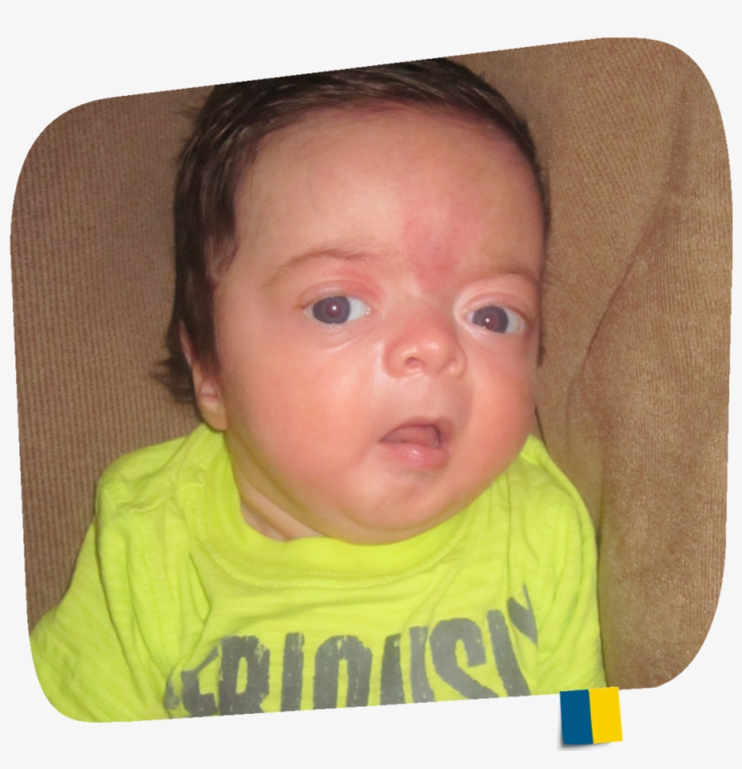 Asxl2 - 02a - Additional Sex Combs Like 2, Transcriptional Regulator, transparent png download