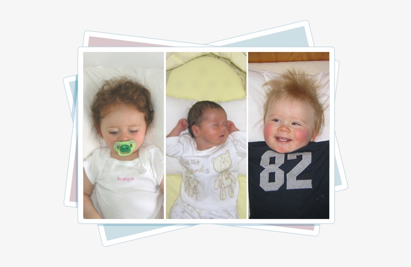 Practice Tummy Time, Several Times A Day During Supervised - Postural Plagiocephaly, transparent png download